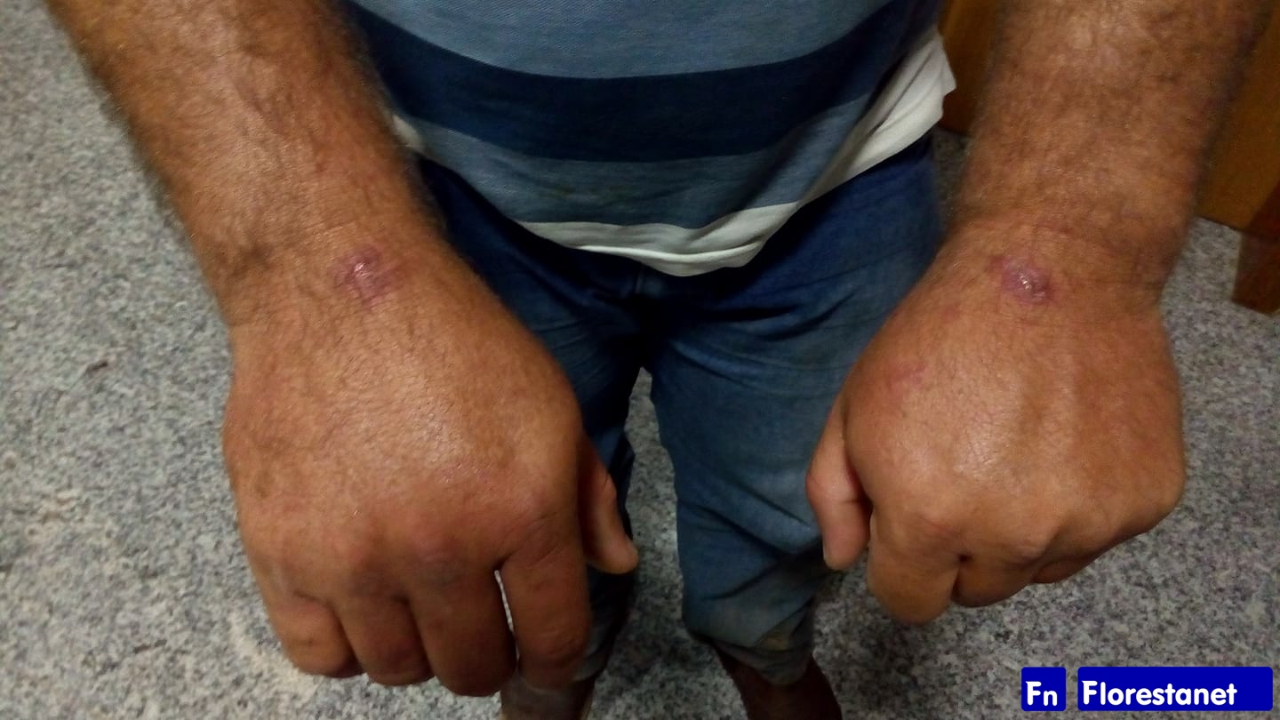 arquivos_32_conteudo_posts_724502_jpg___1_0__jpg_arquivos_32_marca_png_3