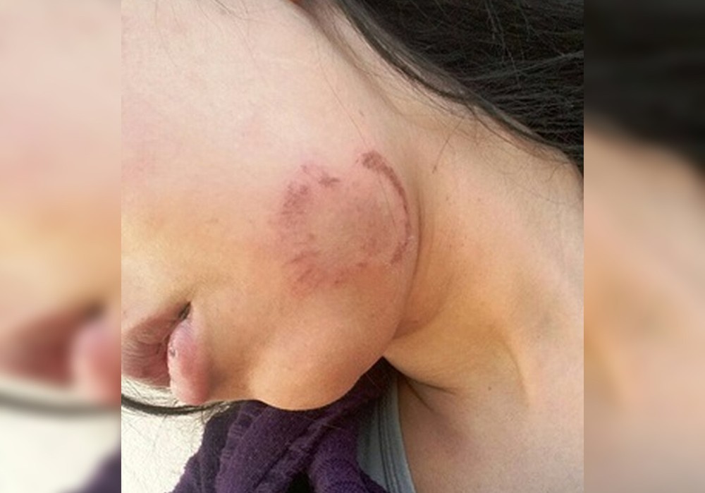 AGRESSÃO MULHER pmmt