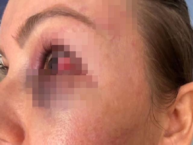 mulher agredida amarrada