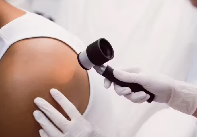 câncer pele tratamento