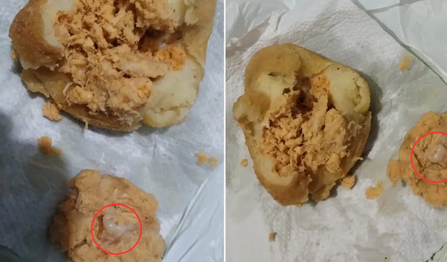 dente humano na coxinha