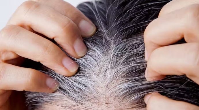 cabelos brancos