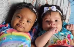 Gêmeas brasileiras que nasceram de cores diferentes são caso raro, afirma ciência