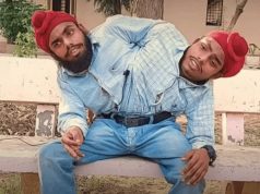 O que são gêmeos siameses? Entenda como o fenômeno raro acontece na medicina