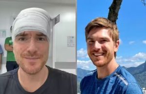 Jornalista dos Estados Unidos é socorrido de graça no SUS e elogia rede pública brasileira; segundo ele, o atendimento que recebeu de graça, chegaria a R$ 50 mil em seu país