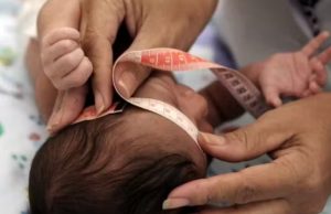 Crianças vítimas do Zika terão indenização de R$ 50 mil e pensão vitalícia; Lei promulgada