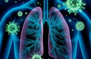 ASSUSTADOR: MT está entre seis estados em alerta por alta de síndrome respiratória, aponta Fiocruz