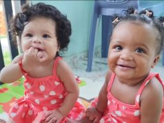 CASO RARO: Gêmeas brasileiras que nasceram com cor de pele diferente cresceram e estão lindas