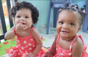 CASO RARO: Gêmeas brasileiras que nasceram com cor de pele diferente cresceram e estão lindas