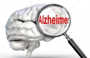 Alzheimer: novo remédio começa a ser vendido no Brasil; retarda a doença