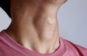 Você Sabia Que o Seu Pescoço Pode Revelar Sinais de Sérios Problemas de Saúde?