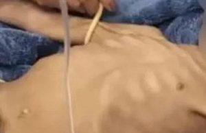 MALDADE E COVARDIA; preso homem que deixou menina de três anos morrer de fome