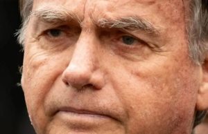Após crise de soluços, ex-presidente Bolsonaro será submetido a nova cirurgia nesta segunda-feira(29)