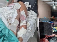 Servidora Pública de Prefeitura sofre ataque a facadas dentro de casa na noite deste domingo(25); marido desferiu mais de 15 golpes