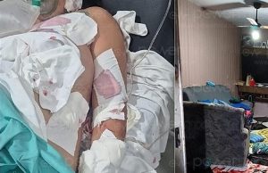 Servidora Pública de Prefeitura sofre ataque a facadas dentro de casa na noite deste domingo(25); marido desferiu mais de 15 golpes