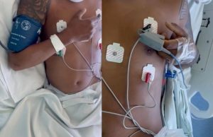 VÍTIMA DE ACIDENTE NUMA CACHOEIRA: jovem tetraplégico é o 5º paciente a se mexer após tratamento com polilaminina