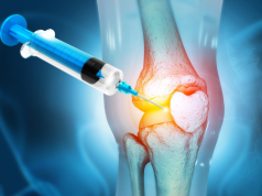 Terapia Inovadora: injeção antienvelhecimento regenera cartilagem do joelho e previne artrite