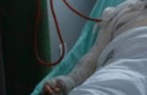 Mulher fica com 40% do corpo queimado após ataque do marido