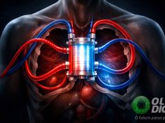 O ‘pulmão artificial’ que manteve paciente vivo por dias até transplante