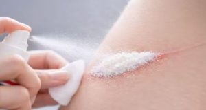 Cientistas criam pó em spray que estanca hemorragia em 1 segundo