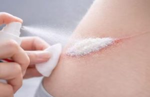 Cientistas criam pó em spray que estanca hemorragia em 1 segundo