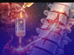 Polilaminina: 23 pacientes paralisados já conseguem se mexer; veja em quais Estados