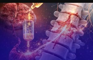 Polilaminina: 23 pacientes paralisados já conseguem se mexer; veja em quais Estados