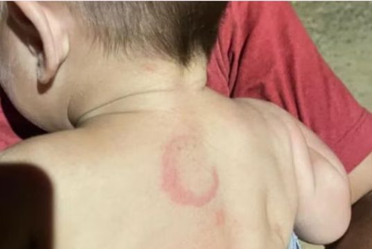 Pai é preso após espancar bebê de 4 meses