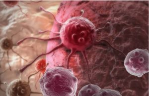 Cientistas desenvolvem bactéria que “come” o câncer: devora tumor de dentro para fora