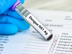 SUS agora tem teste rápido para dengue; veja como funciona