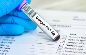 SUS agora tem teste rápido para dengue; veja como funciona