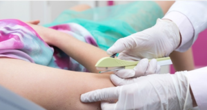 Neste fim de semana Mutirão da saúde da mulher garante implante anticoncepcional gratuito pelo SUS; evita gravidez por 3 anos