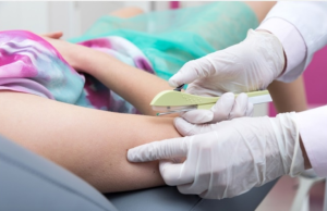 Neste fim de semana Mutirão da saúde da mulher garante implante anticoncepcional gratuito pelo SUS; evita gravidez por 3 anos