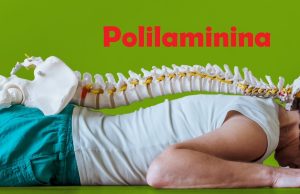 Testes clínicos da polilaminina começam em abril, revela dra. Tatiana Sampaio