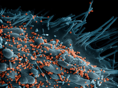 VÍRUS LUJO: patógeno emergente com taxa de letalidade de 80% preocupa cientistas