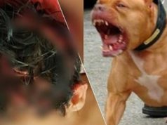 Ataque de pitbulls deixa criança ferida e dona do animal acaba presa