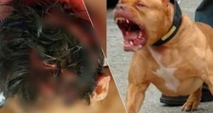 Ataque de pitbulls deixa criança ferida e dona do animal acaba presa