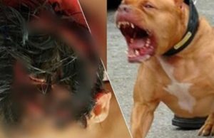 Ataque de pitbulls deixa criança ferida e dona do animal acaba presa