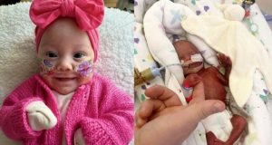 Bebê que nasceu de 22 semanas com 500 gramas tem alta do hospital e vai para casa