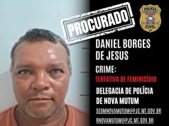 NORTE MT: homem é procurado após atacar ex-companheira com mais de 15 golpes de faca