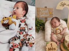 Bebê Noah, dado como morto, deixa a UTI, respira sem aparelhos e já recebe visitas
