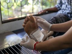 UMA ESPERANÇA PARA MILHARES: USP desenvolve nanopartícula que quase fecha ferida crônica 72 horas