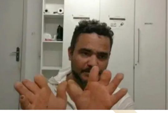 ESSE É O BRASIL QUE QUEREMOS, ONDE A JUSTIÇA PESA MAIS PARA QUEM TEM MENOS? Homem com hanseníase, aposentado por invalidez e que sobrevive com R$ 880 terá que pagar multa de R$ 16 mil