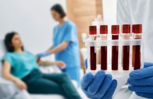 Chega ao Brasil novo exame de sangue que busca detectar mais de 50 tipos de câncer
