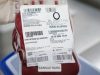 Deu certo! Paciente de 63 anos recebe sangue raríssimo enviado de avião do um Estado para o oubro